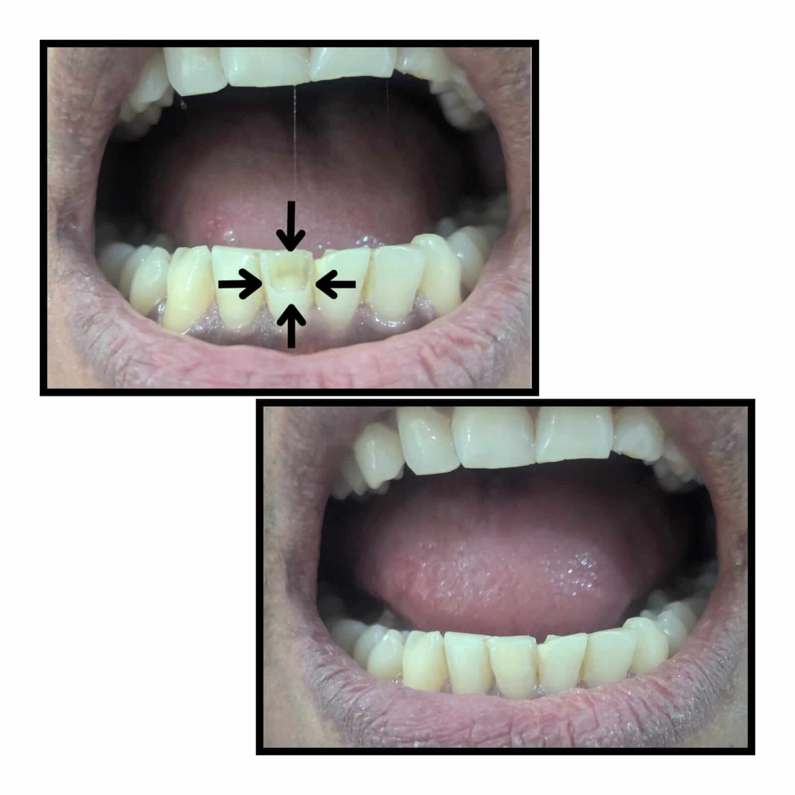before-after